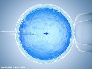 一般不妊検査・タイミング療法