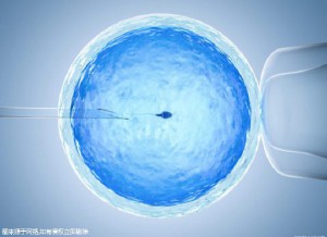 体外受精 IVF-ET